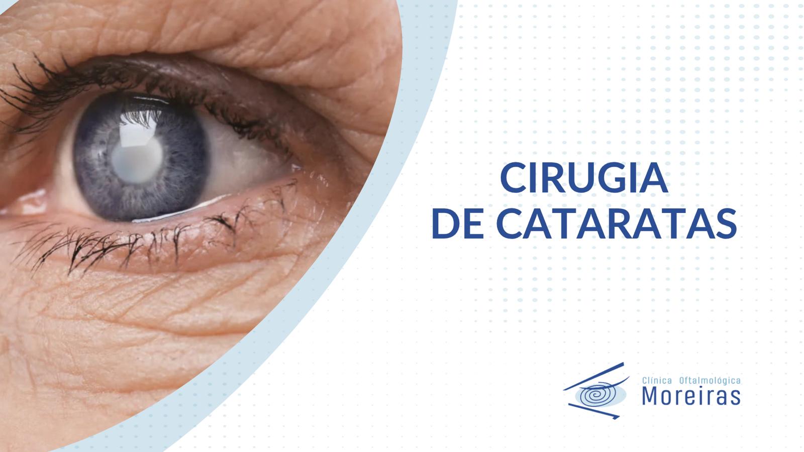 Cirugia de Cataratas en Clinica Moreiras
